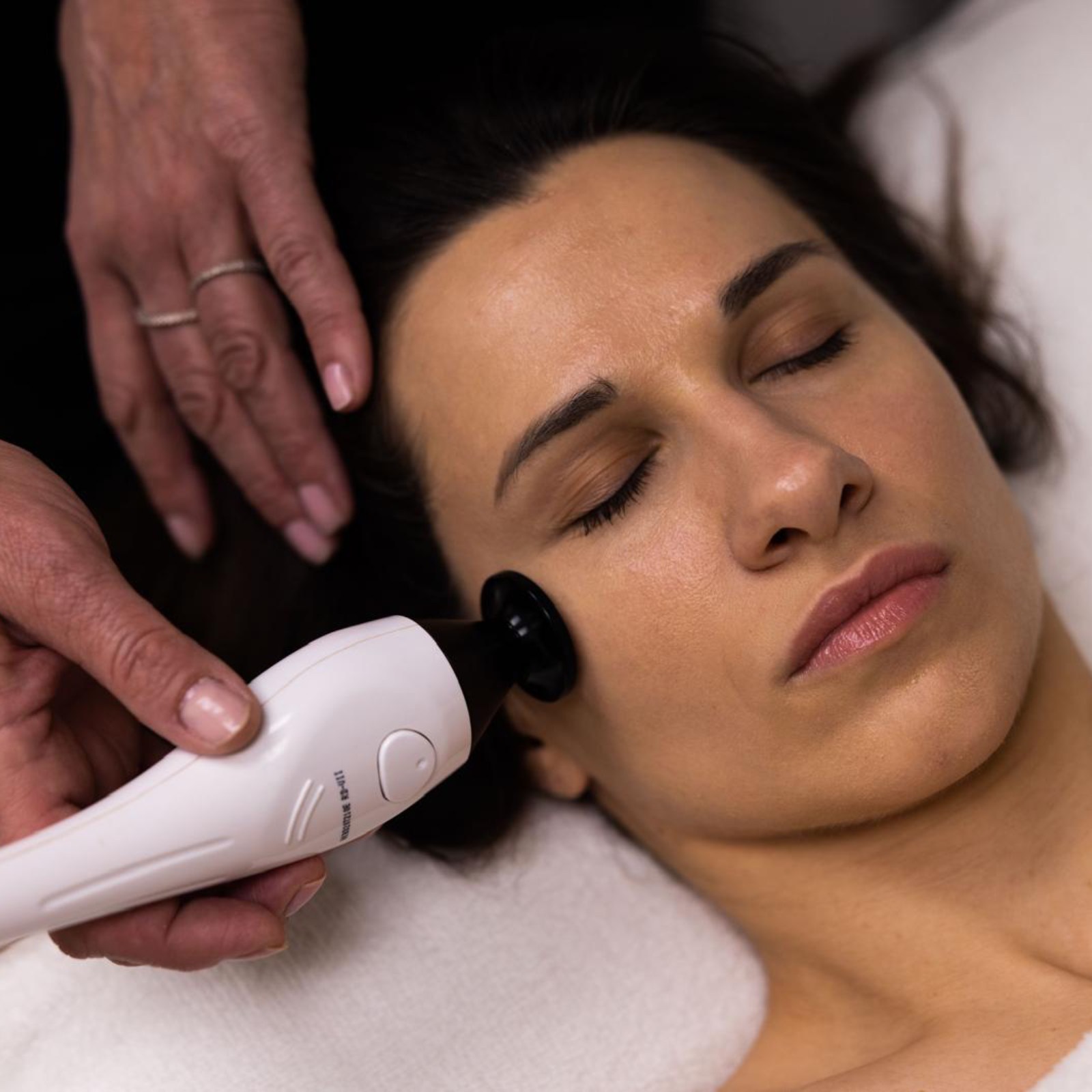 Radio Frequency Treatment