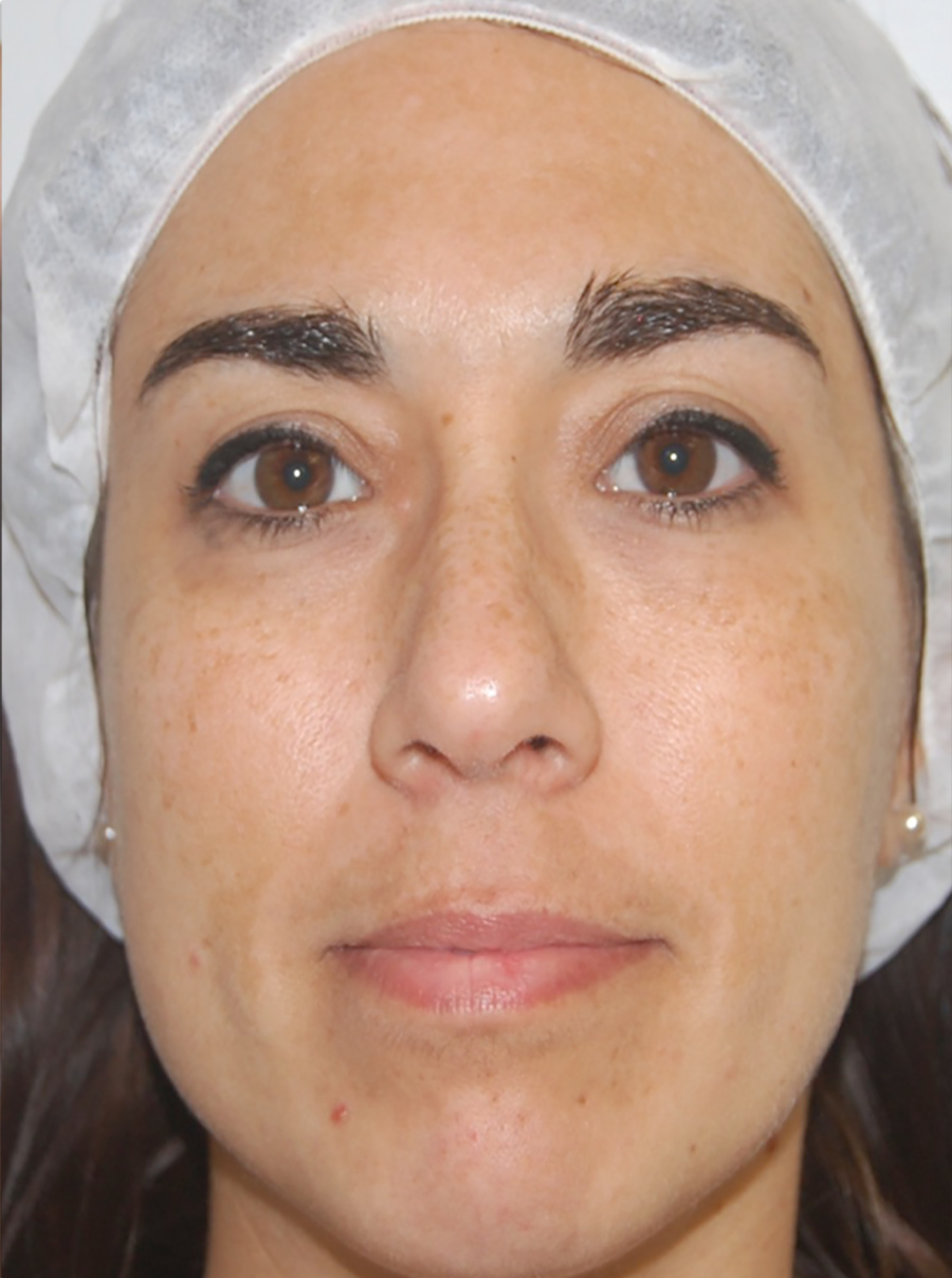 Saizar_toning_before